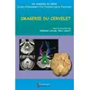 Image de Imagerie du cervelet Stéphane Louryan (Auteur), Marc Lemort (Auteur)