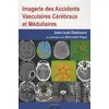 Image de Imagerie des accidents vasculaires cérébraux et médullaires en occasion ou reconditionné
