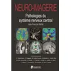 Image de Neuro-imagerie. pathologies du systeme nerveux central 2ed Jean-François Meder (Auteur)