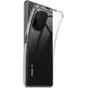Image de Xeptio Coque smartphone Xiaomi Mi 11i 5G