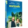 Image de Normale