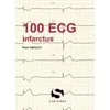 Image de 100 Ecg Infractus