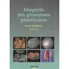 Image de IMAGERIE DES GROSSESSES GEMELLAIRES en occasion ou reconditionné