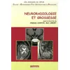 Image de Neuroradiologie Et Grossesse