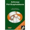 Image de Arthrose PÃ©ri-ScaphoÃ¯dienne