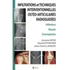 Image de Infiltrations Et Techniques Interventionnelles OstÃ©o-Articulaires RadioguidÃ©es - Infiltrations, Biopsies, Cimentoplasties