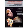 Image de Chirurgie Du Ligament CroisÃ© AntÃ©rieur Du Genou - La LÃ©sion Du Lca : Le "Retour Externe" : Pourquoi ?