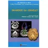 Image de Imagerie Du Cervelet