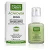 Image de Martiderm Sérum Visage Acniover 30ml One Size