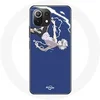 Image de Coque pour Xiaomi Mi 11 Lite Killua Zoldyck Hunter x Hunter Anime Manga