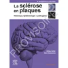 Image de La sclérose en plaques - historique, épidémiologie et pathogénie