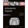 Image de Orthodontie linguale