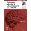 Image de Epilepsies de l'enfant, de l'adolescent et de l'adulte
