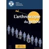 Image de L'arthroscopie du genou