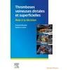 Image de Thromboses veineuses distales et superficielles