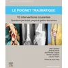 Image de Le poignet traumatique 10 interventions courantes
