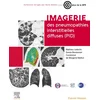 Image de Imagerie des pneumopathies interstitielles diffuses (pid)