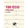 Image de 100 ecg infractus