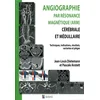Image de Angiographie par resonance magnetique (arm) cerebrale et medullaire