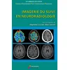 Image de Imagerie du suivi en neuroradiologie