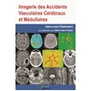 Image de Imagerie des accidents vasculaires cerebraux et medullaires