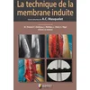 Image de La technique de la membrane induite