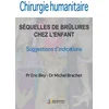Image de Séqueles de brûlures chez l'enfant