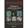 Image de Neuro-imagerie