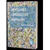 Image de Arythmies cardiaques expliquées