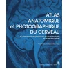 Image de Atlas anatomique et photographique du cerveau