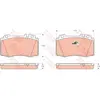 Image de Kit De Plaquettes De Frein, Frein À Disque Trw Automotive Gdb1454 Mercedes-benz
