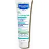 Image de Mustela Stelatopia+ Crème nourrissante apaisante relipidante anti-démangeaisons 150 ml