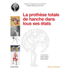 Image de La prothèse totale de hanche dans tous ses états