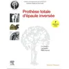 Image de Prothèse totale d'épaule inversée