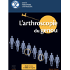 Image de L'arthroscopie du genou