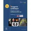 Image de Imagerie cardiaque : imagerie en coupes : tomodensitométrie, IRM