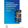 Image de Thromboses veineuses distales et superficielles