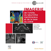 Image de Imagerie de l'orbite, du labyrinthe membraneux et de la base du crâne