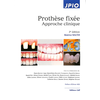 Image de Prothèse fixée : approche clinique