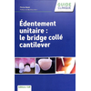Image de Edentement unitaire : le bridge collé cantilever
