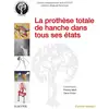 Image de La prothèse totale de hanche dans tous ses états Collectif