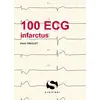 Image de 100 ECG infarctus Pierre Taboulet