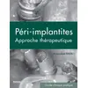 Image de Péri-implantites - approche thérapeutique - guide clinique pratique Amandine Para